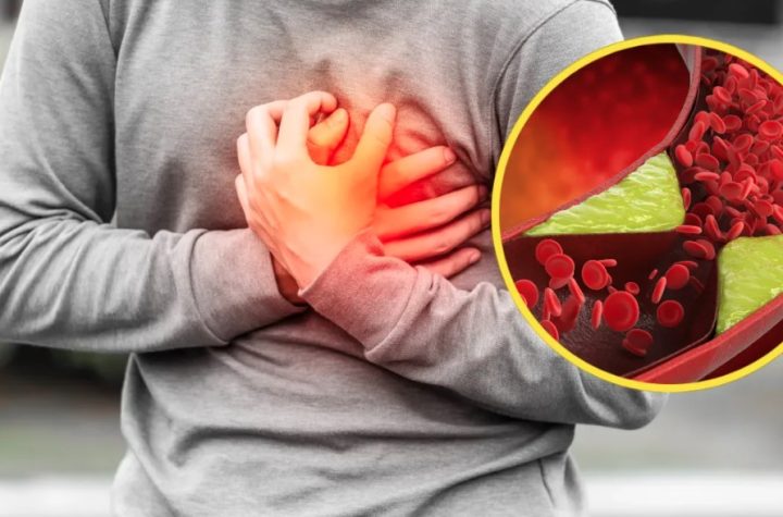 हाई कोलेस्ट्रॉल से बढ़ता है दिल की बीमारी का खतरा, जानिए कैसे करें बिना दवा के कंट्रोल