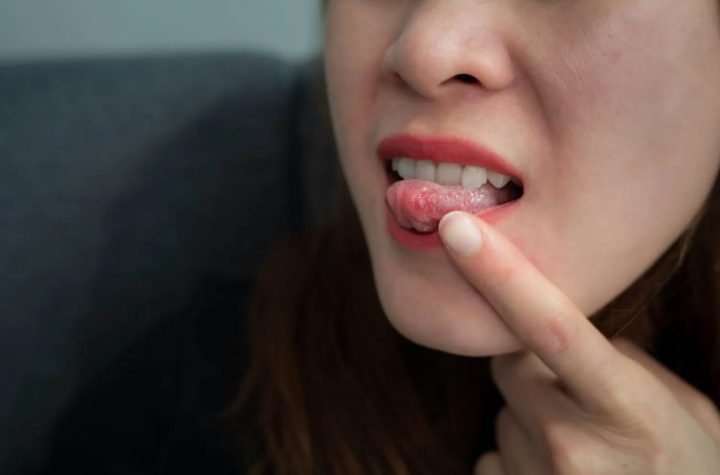तीन हफ्ते से नहीं भर रहा मुंह का घाव? हो सकता है ओरल कैंसर का संकेत